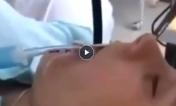 “Bunca yıllık anestezistim ilk defa böyle vaka görüyorum”