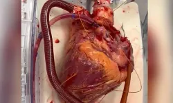 VİDEO HABER / Nakiledilecek olan bir insan kalbi