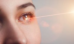 Göz Çizdirme Ameliyatı (Excimer Lazer) Nedir?