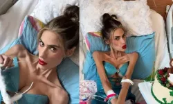 Anoreksiya hastası Nihal Candan öldü mü? Nihal Candan'ın sağlık durumu nasıl?