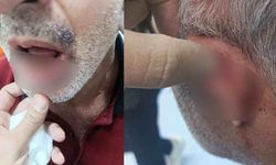Gaziantep'te sağlıkta şiddet skandalı! Hasta yakını darp etti...
