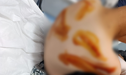 Şanlıurfa'da 17 yaşındaki çocuk 11 yaşındaki çocuğu döverek hastanelik etti