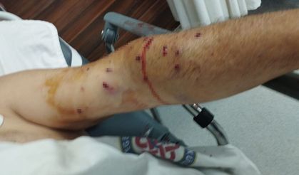 TIR sahibi 180 liralık kantar ücreti için çalışanı vurdu