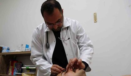 Gaziantep'te Akupunktur tedavisiyle sağlıklarına kavuştular