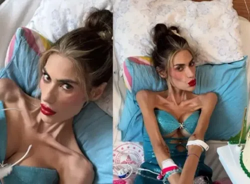 Anoreksiya hastası Nihal Candan öldü mü? Nihal Candan'ın sağlık durumu nasıl?