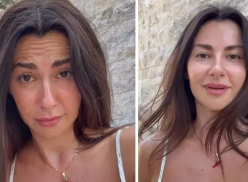 Botoks yorumlarına isyan etti! Nesrin Cavadzade'den estetik iddialarına videolu yanıt geldi...