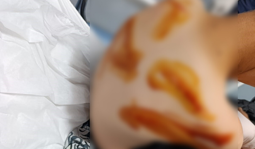 Şanlıurfa'da 17 yaşındaki çocuk 11 yaşındaki çocuğu döverek hastanelik etti