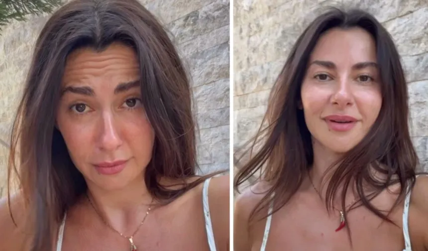Botoks yorumlarına isyan etti! Nesrin Cavadzade'den estetik iddialarına videolu yanıt geldi...
