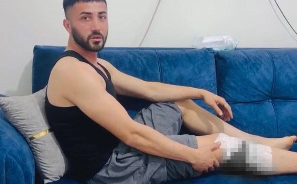 Nizip'te başıboş köpek saldırısında 2 kişi yaralandı