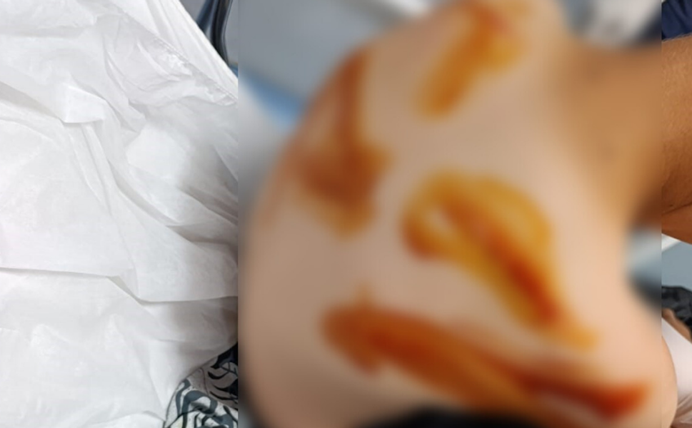 Şanlıurfa'da 17 yaşındaki çocuk 11 yaşındaki çocuğu döverek hastanelik etti