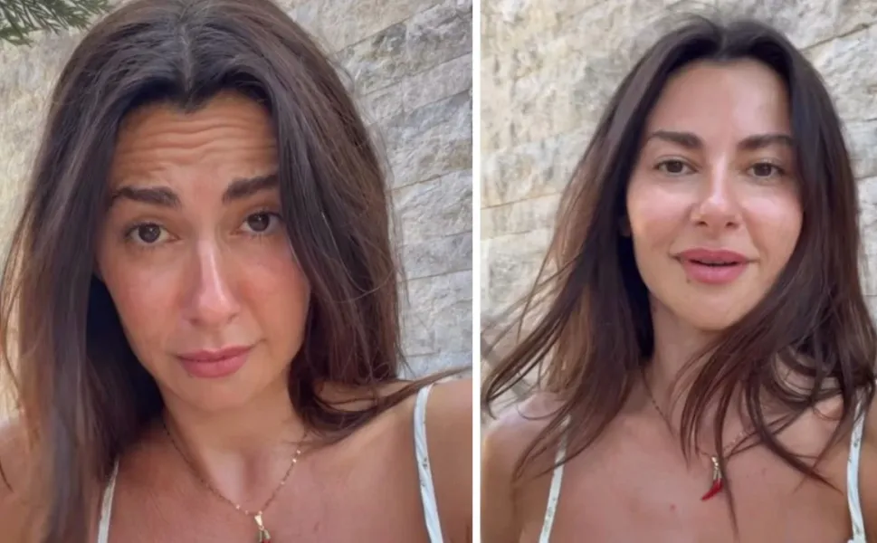Botoks yorumlarına isyan etti! Nesrin Cavadzade'den estetik iddialarına videolu yanıt geldi...