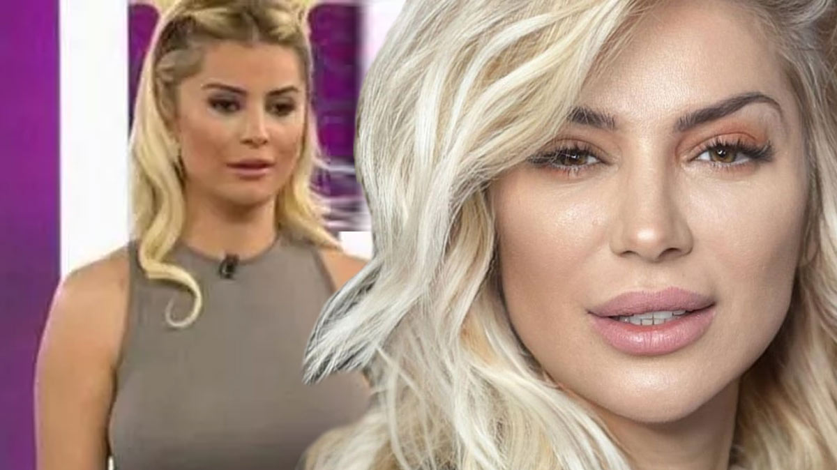 Songul Karli Estetik Sonrasi Makyajsiz Paylasti Sosyal Medya Yikildi Estetiklere Doymayan Karlinin Son Hali Me 1682080164550