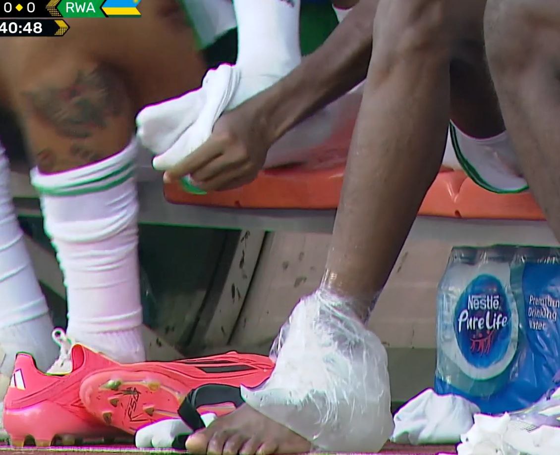 G0 Lc P2N Xg A A X On4